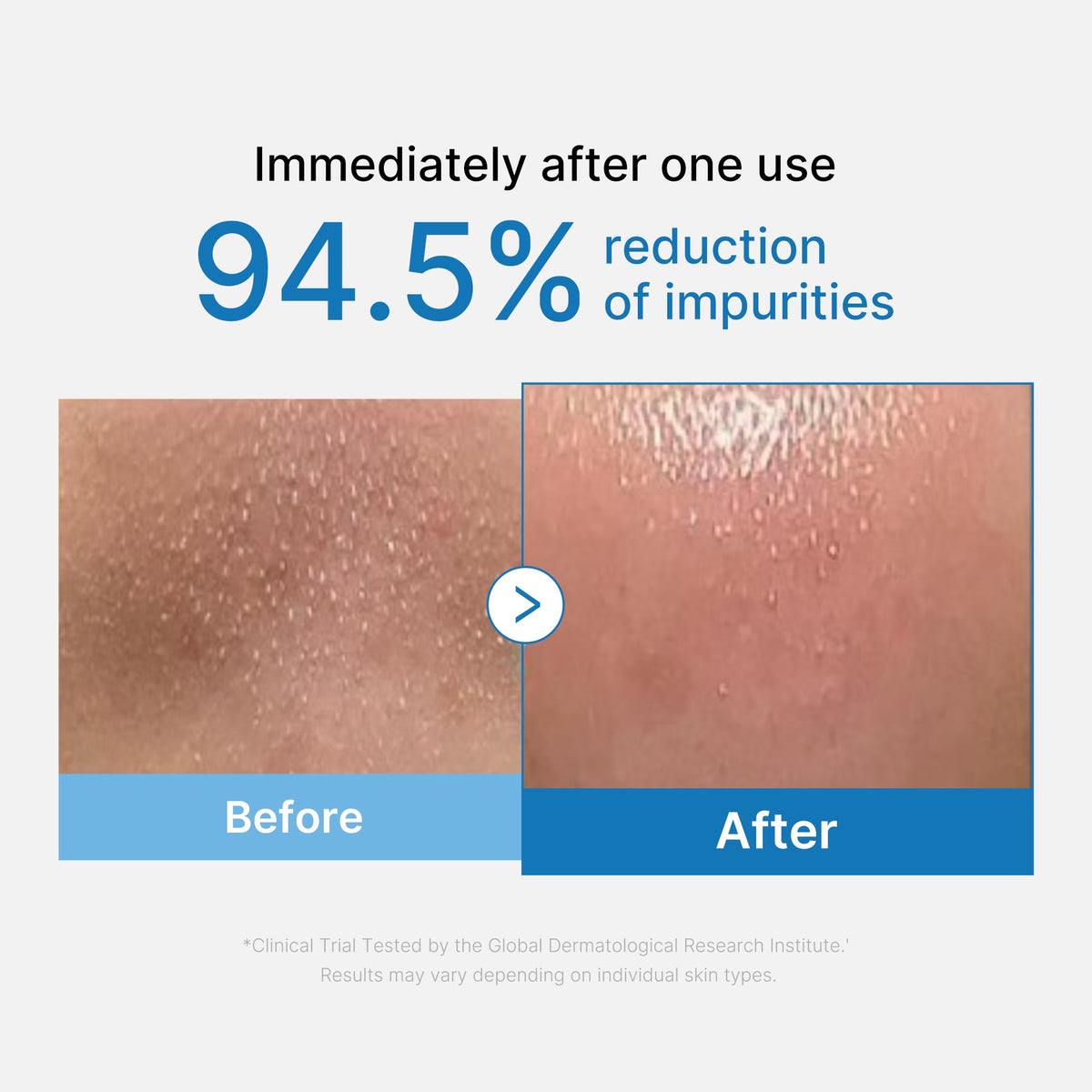 zero-pore-blackhead-deep-cleansing-oil-t4 01_eed557ec-5857-46a2-8b17-dbd67c692dcb.jpg