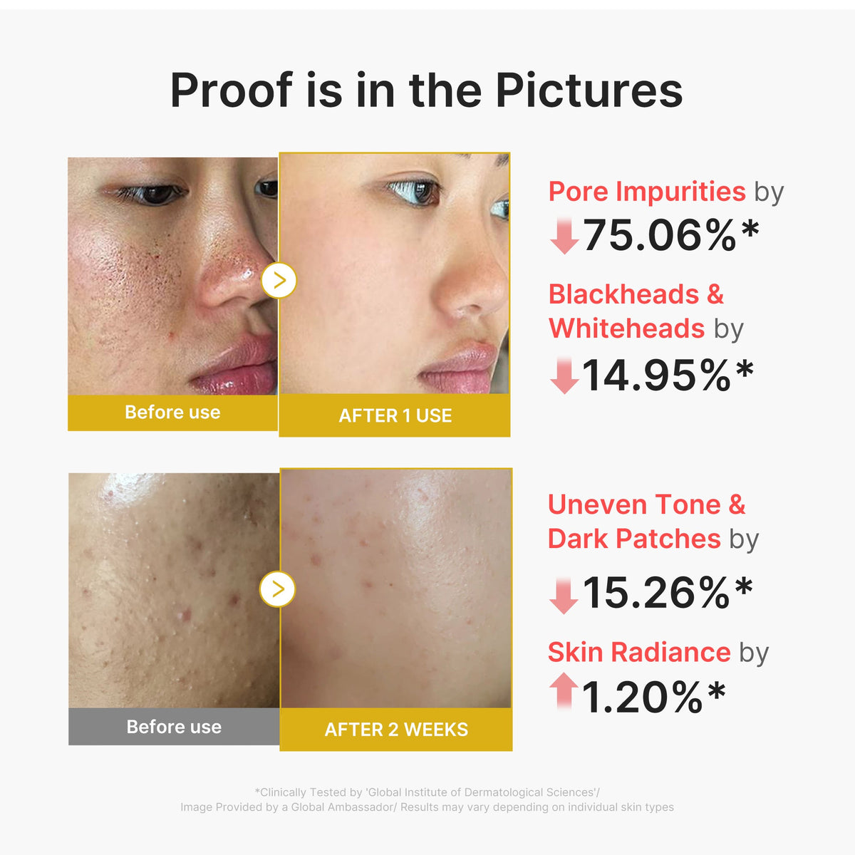 kojic-acid-turmeric-peel-shot-s8 02_45fe66d3-b3f6-4100-aa52-2afd7eded417.jpg