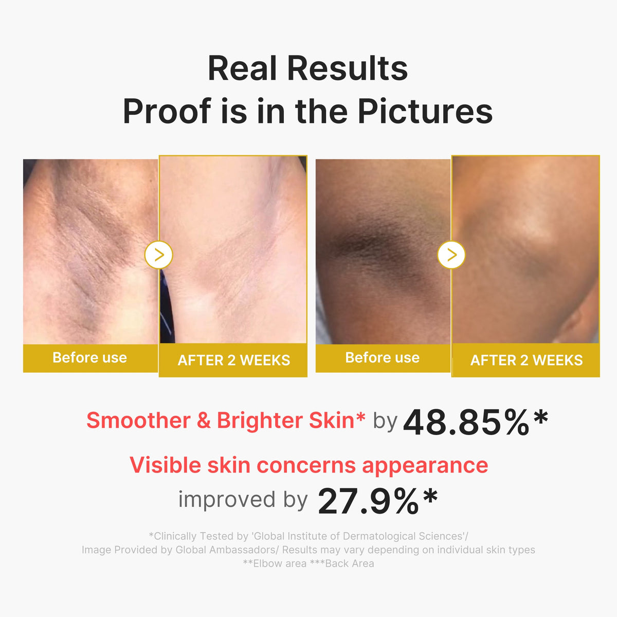 kojic-acid-turmeric-body-peel-shot-r6 02_72880cfc-382b-440b-8152-7e3dce87da2a.jpg