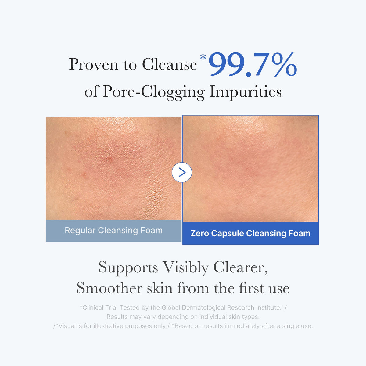 zero-pore-capsule-cleansing-foam-d5 02_c1fb9dfb-86c5-4038-8ff8-490d1006276c.jpg