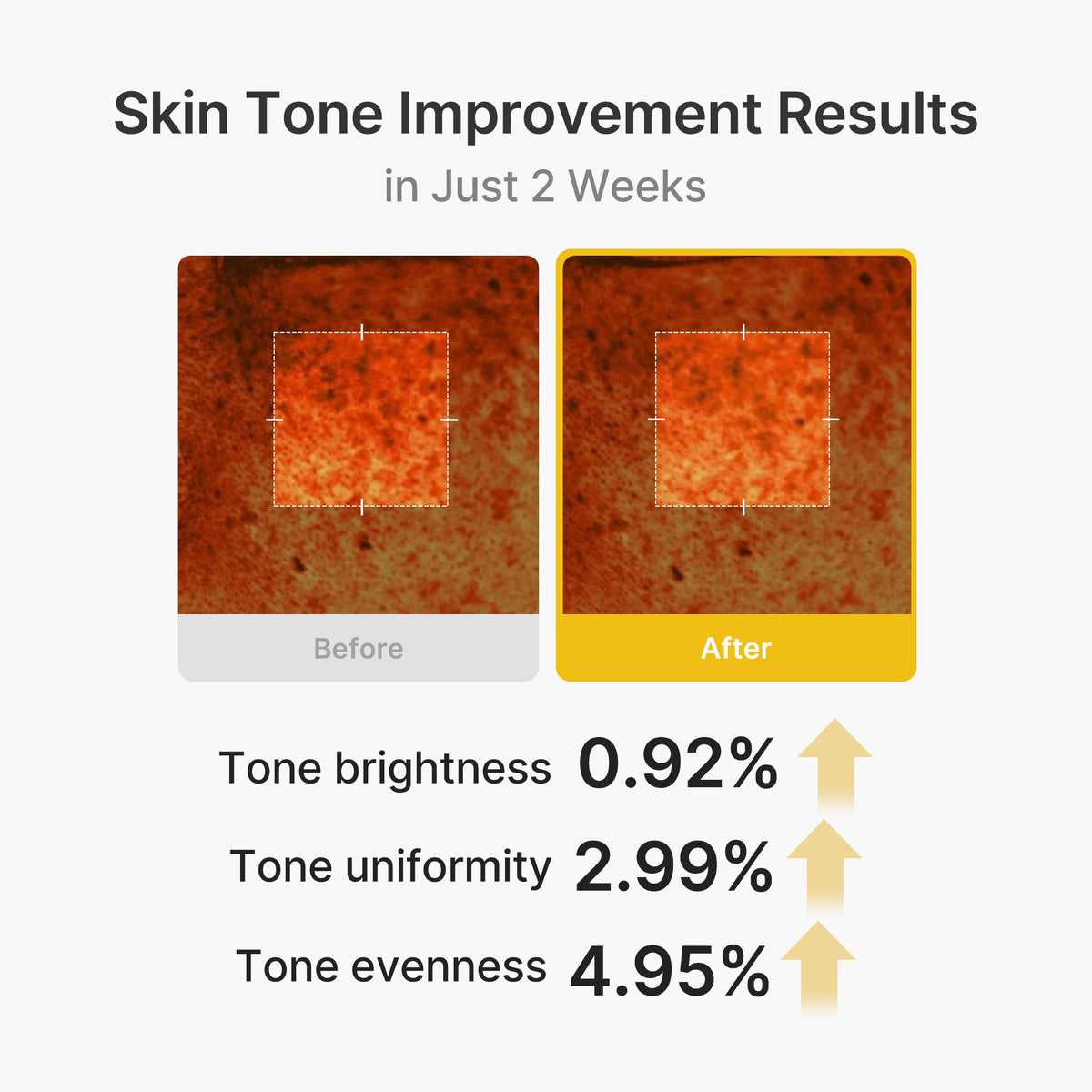 kojic-acid-turmeric-vita-capsule-cream-g7 03_2b626701-fc6c-4702-9e96-a2157a4f7f9d.jpg