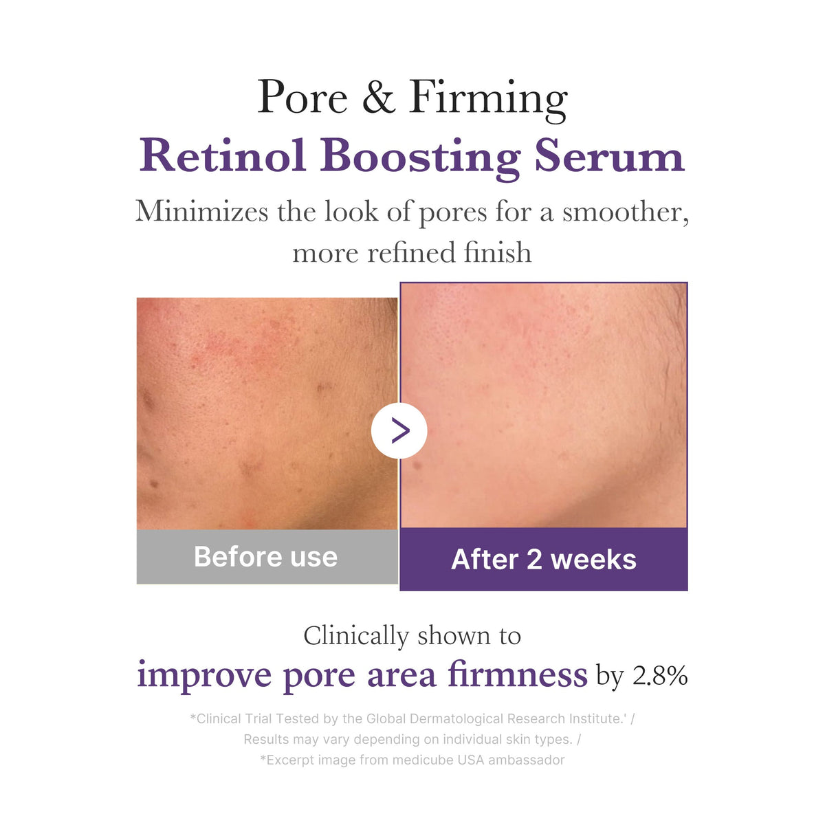 retinol-nmn-boosting-serum-b8 03_3510e7a5-5633-4a18-81ea-1389593bd517.jpg