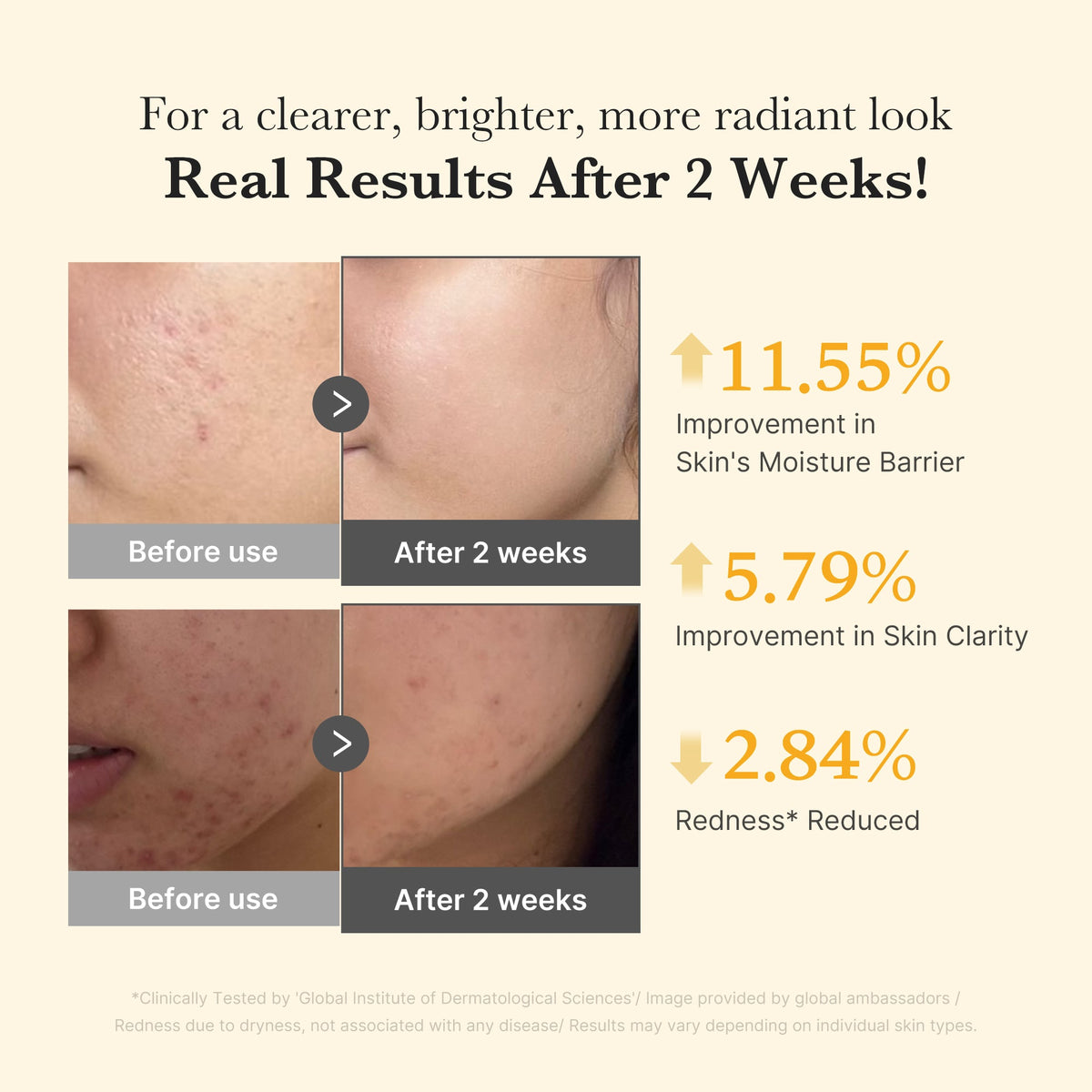 kojic-acid-turmeric-capsule-serum-w5 03_436487f5-76df-490e-8a61-01118373efbd.jpg