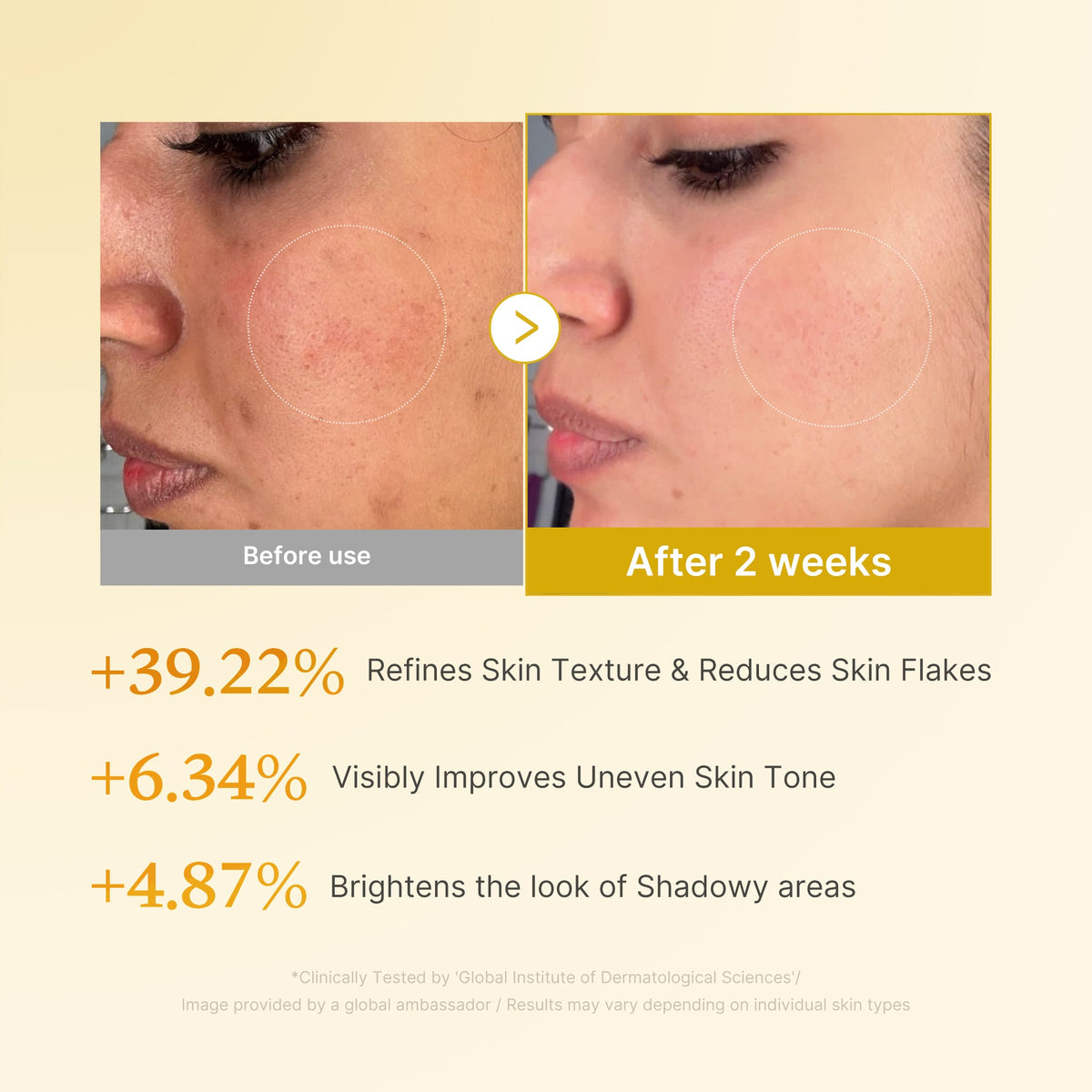 kojic-acid-turmeric-toner-v6 03_b7578d52-4c93-4407-9c6c-7cb230c85b06.jpg