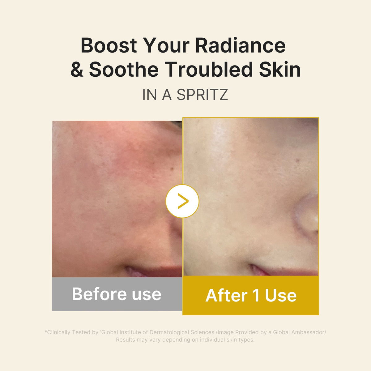 kojic-acid-turmeric-vitamin-gold-jelly-mist-serum-r4 03_dc9cd19e-4e57-49d3-9b66-c7762e8a63f1.jpg