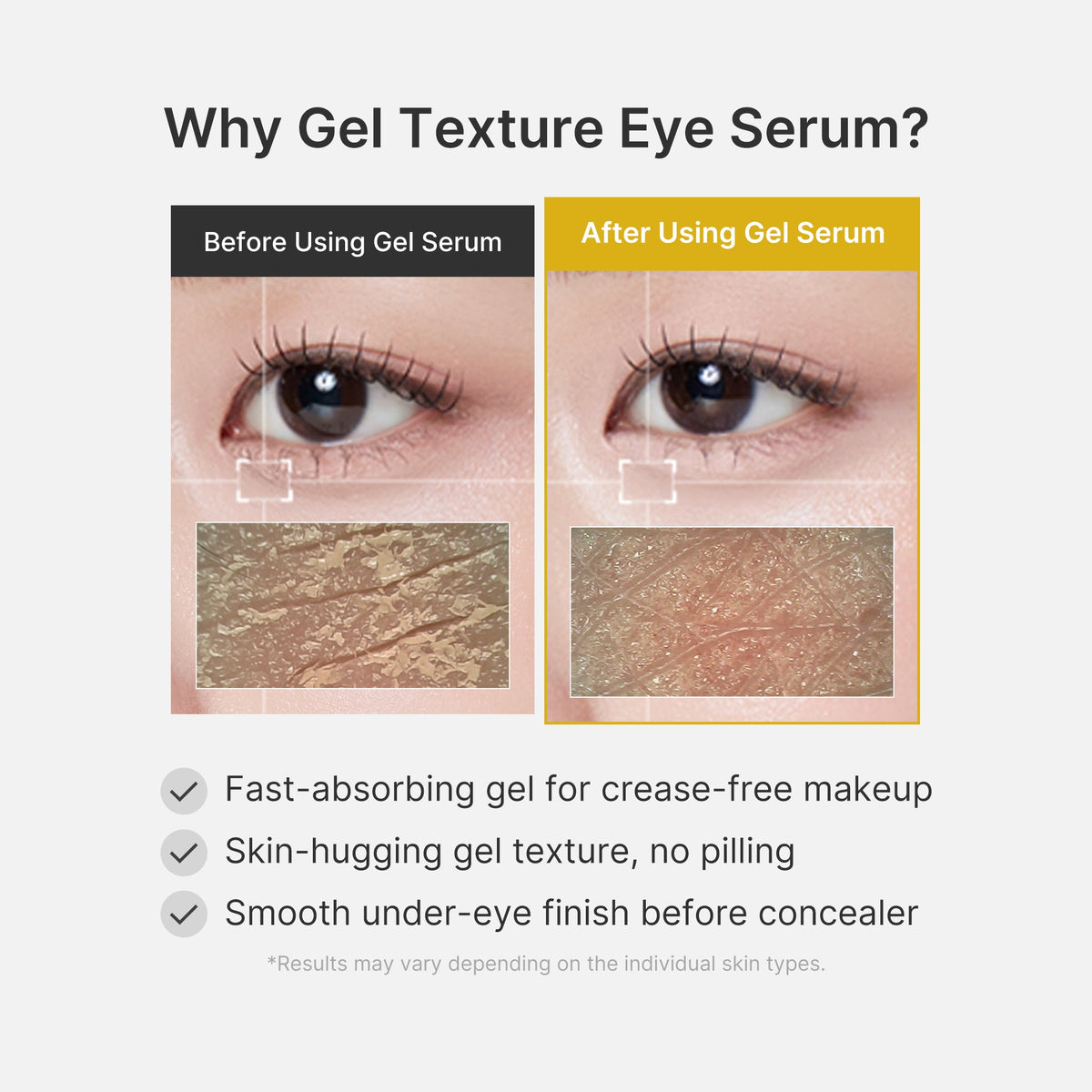 kojic-acid-tumeric-eye-gel-serum-u5 04_0487ef36-49f4-4294-8049-bb55118b05fe.jpg