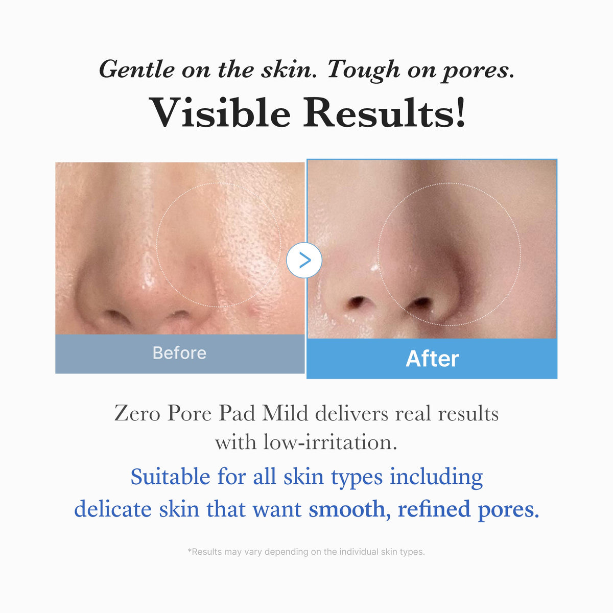 zero-pore-madecassoside-pads-mild-k8 04_6357f9f9-483b-4891-82c6-a58d336e62c8.jpg