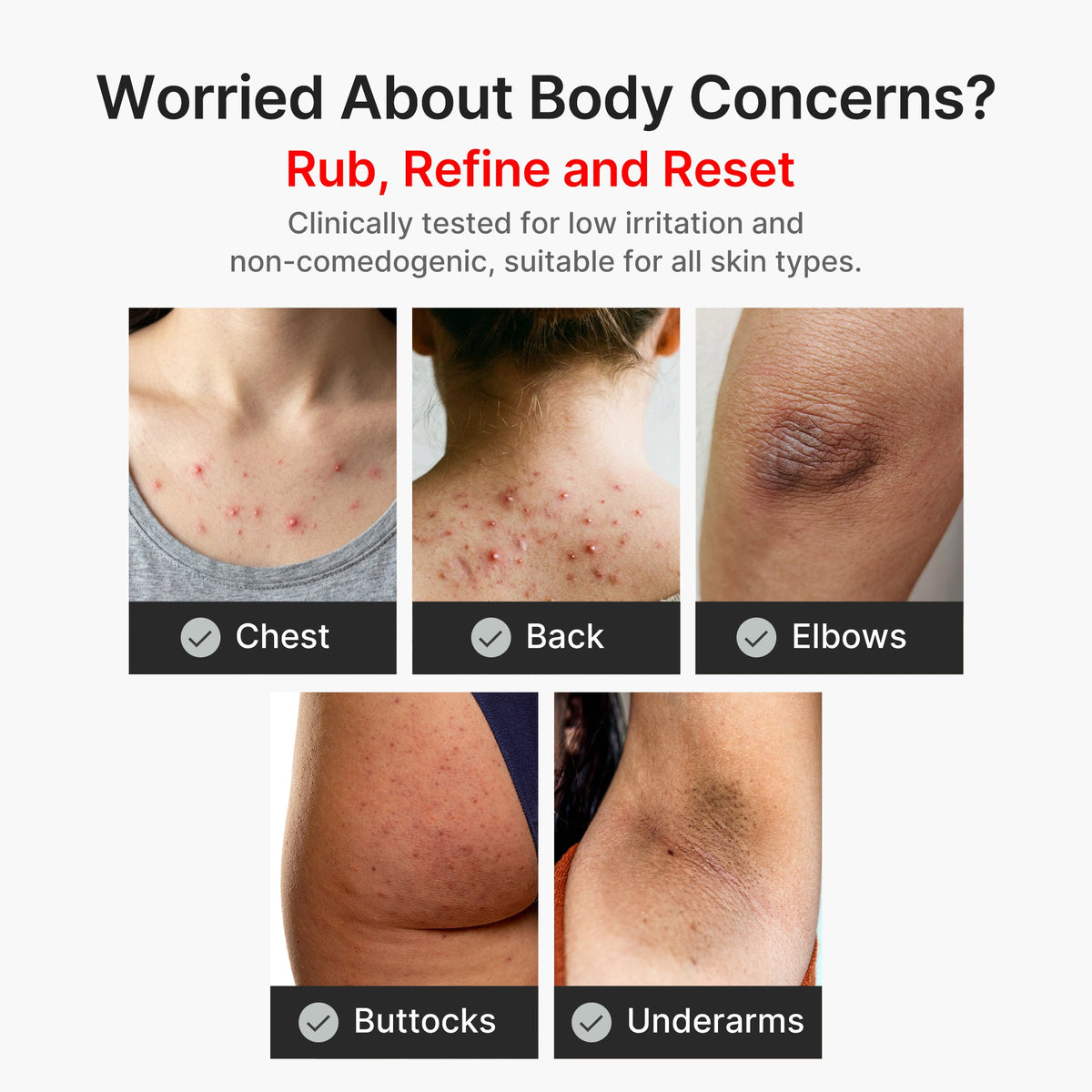 kojic-acid-turmeric-body-peel-shot-r6 04_8a7237f2-3ebf-401e-bd85-54841aeb3efc.jpg