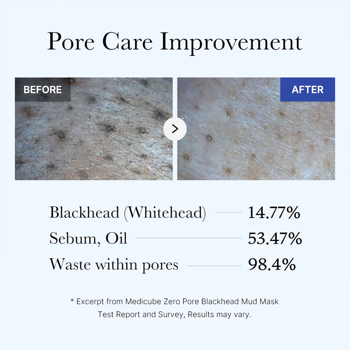 zero-pore-blackhead-mud-mask-g2 05_9362a158-c2b3-4525-acc0-631a2cfdea47.jpg