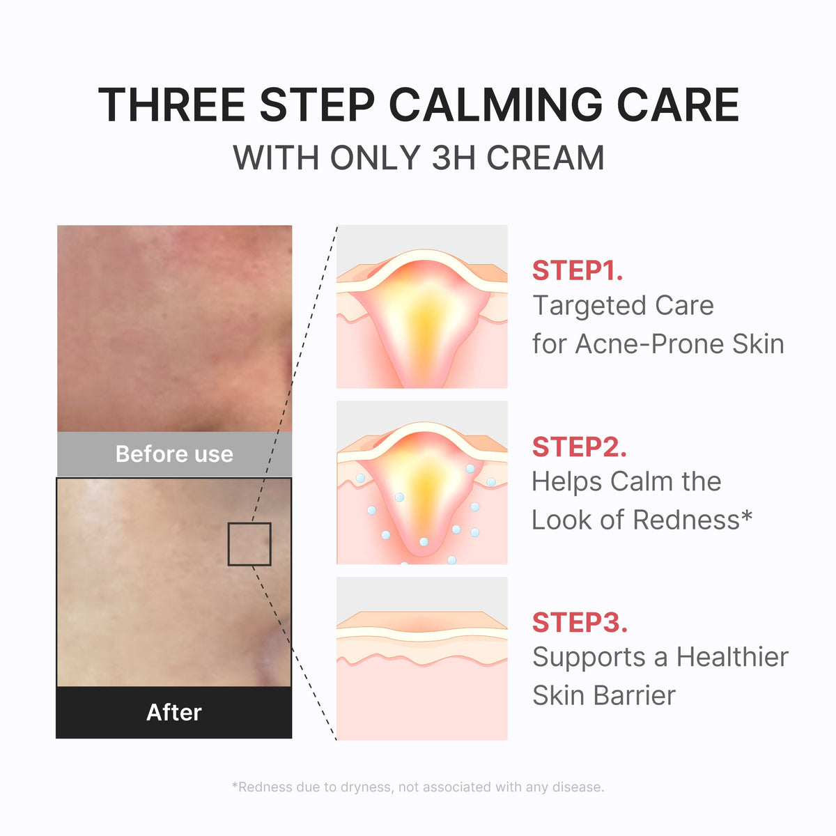 3h-daily-relief-cream-i7 3H_04.jpg
