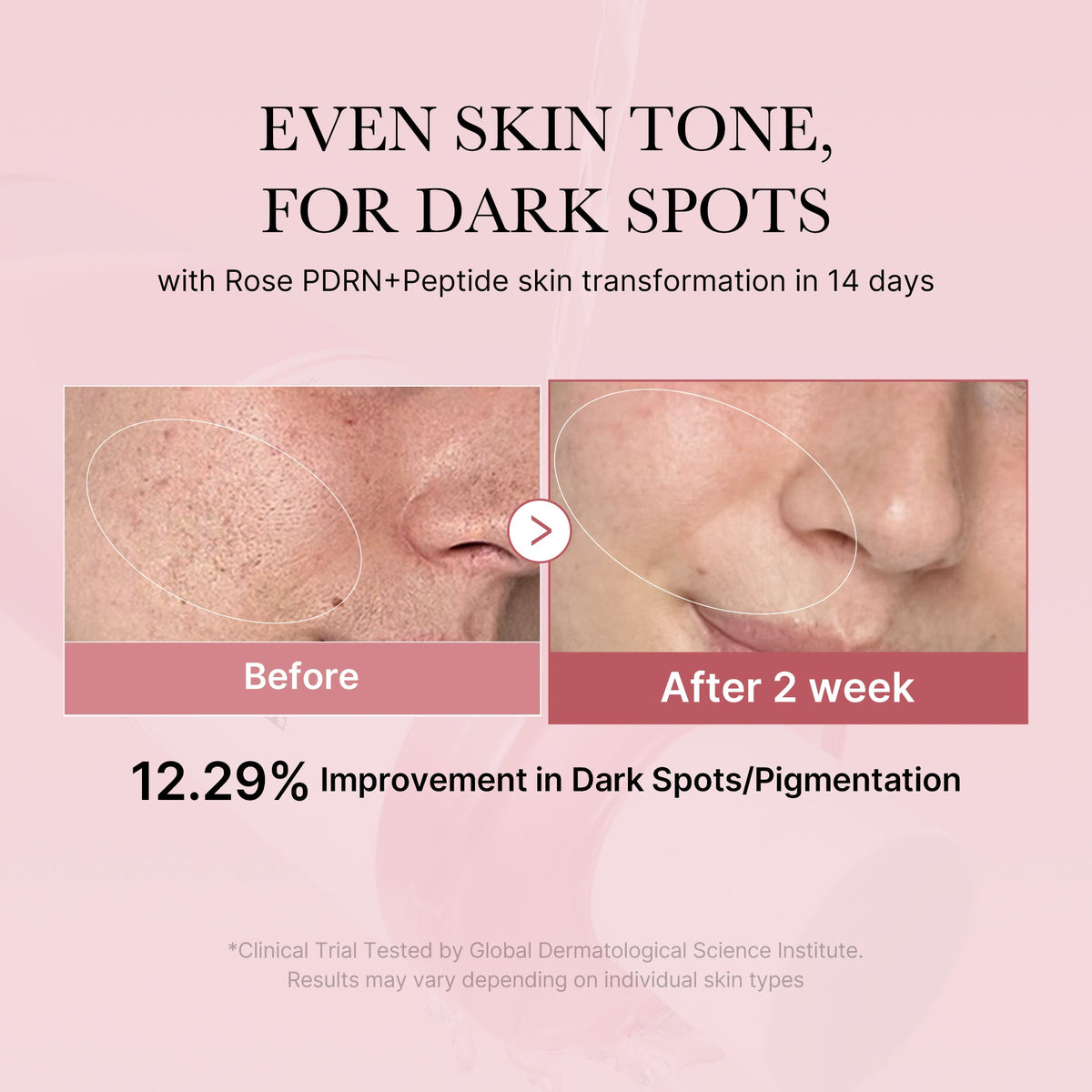 pdrn-pink-peptide-toner-p1 PDRN_01_308c518e-5ac6-4e54-99bd-eabc8796739b.jpg