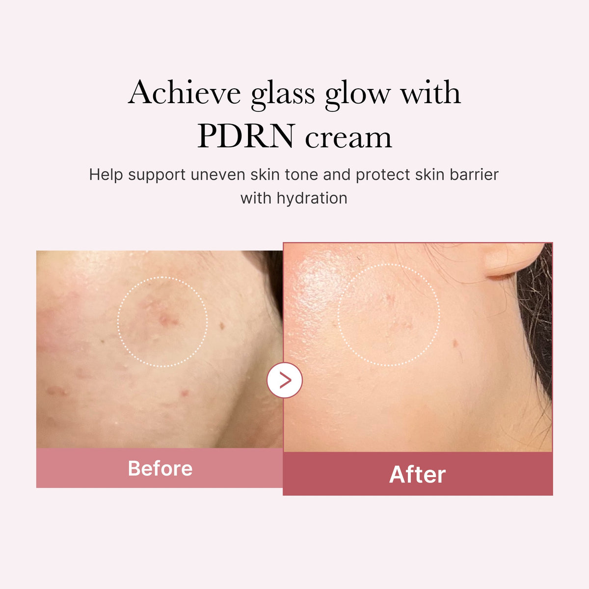 pdrn-pink-peptide-cream-i3 PDRN_02_d7805bfe-cf43-446a-b71b-a276683f136b.jpg
