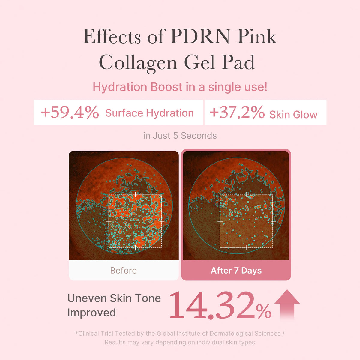 pdrn-pink-collagen-gel-toner-pad-e7 PDRN_04_f9a16a56-8d9e-4c47-a635-ed34ec3ed571.jpg