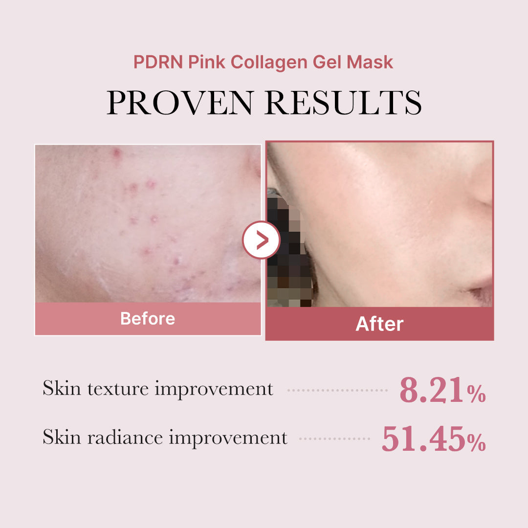 salmon-pdrn-pink-collagen-jelly-gel-mask-r0 PDRN_12.jpg